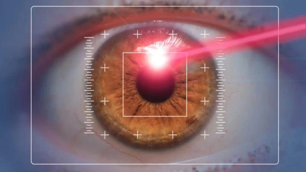 LASIK Surgery Age Limit