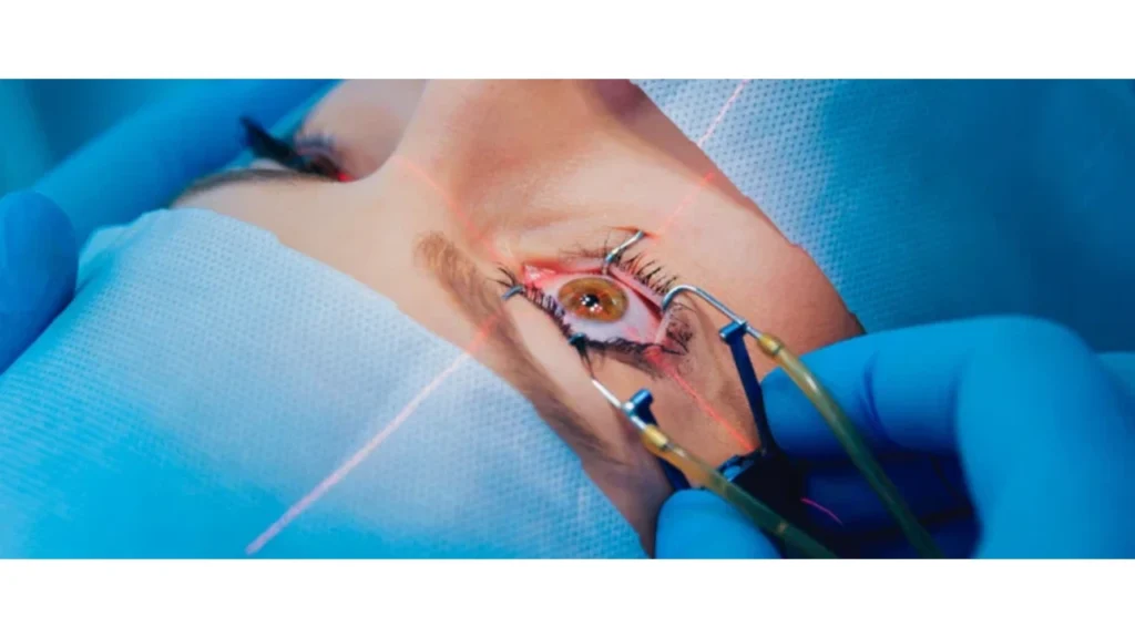 LASIK Surgery and Patients Over 50